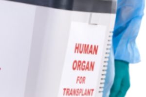 Liver Transplant Basics