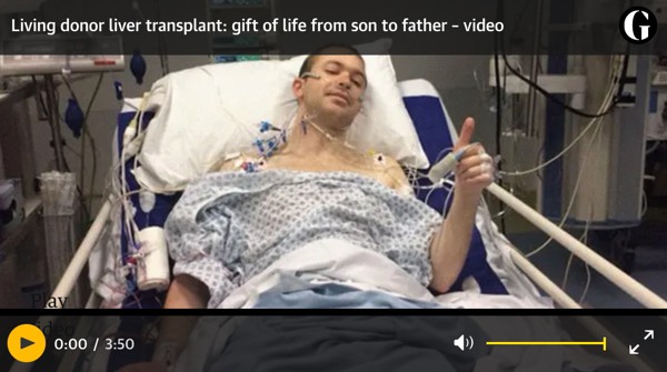 Noam Tamir Jonny Living Donor Liver Transplant